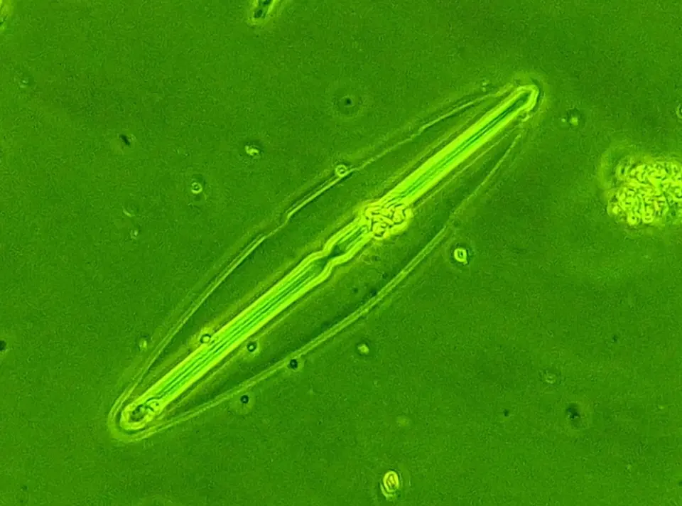 Diatomea observada al microscopio